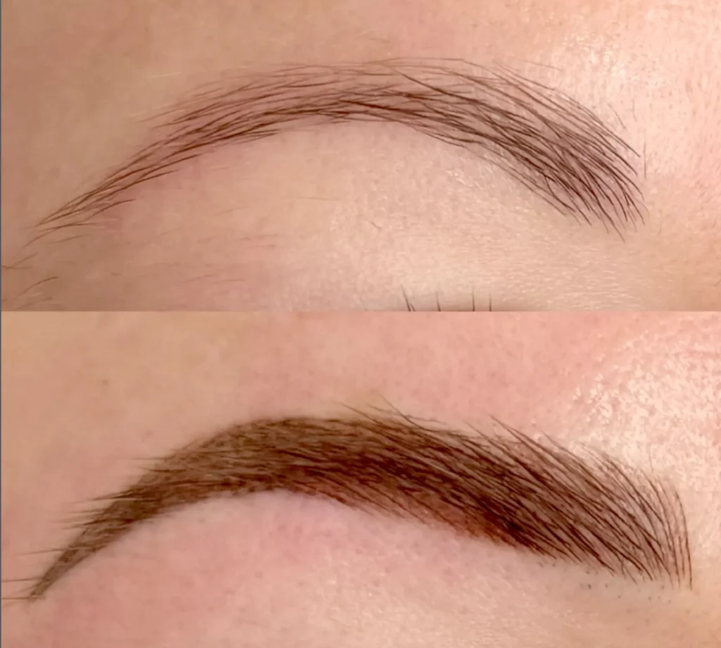 cosmetic procedures