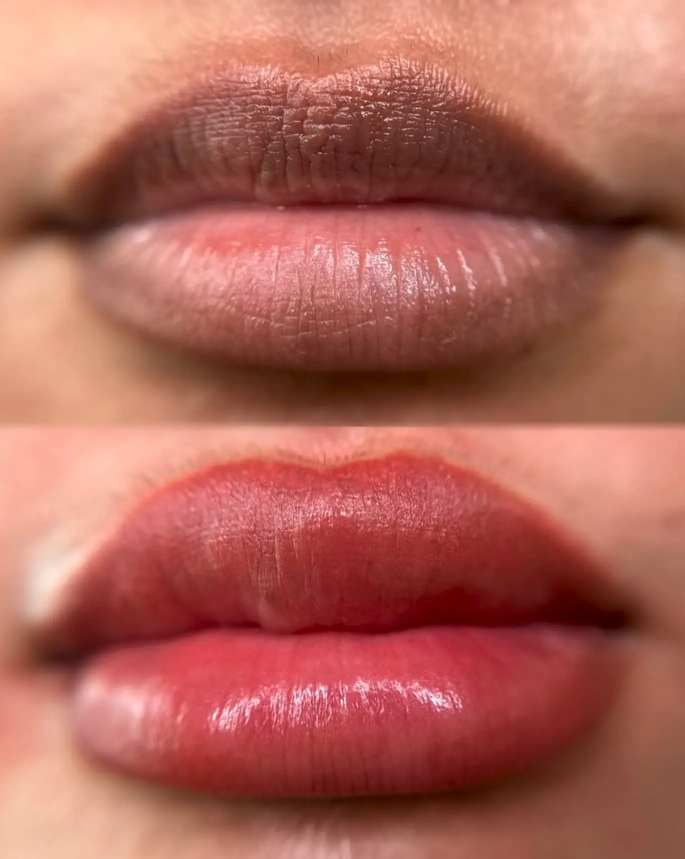Why no Botox after microblading