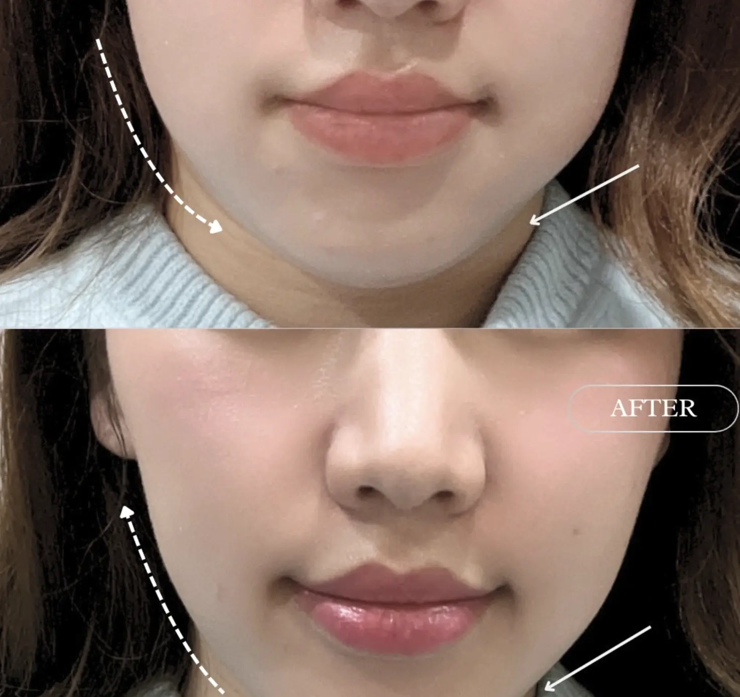 alma skin face sculpting device reviews