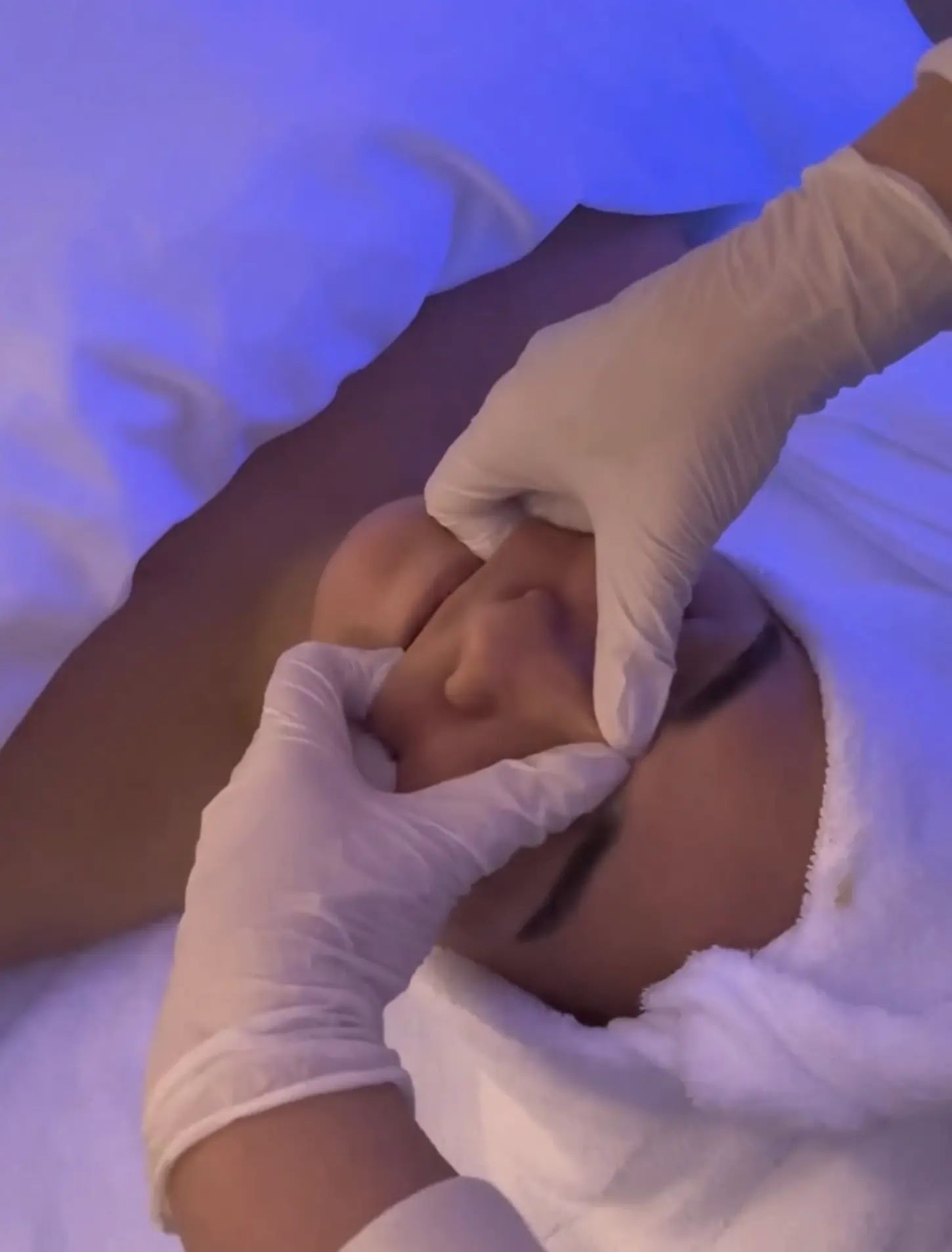 face sculpting laser